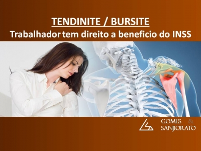 ACIDENTE DE TRABALHO