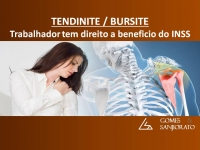 ACIDENTE DE TRABALHO